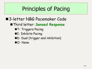 Principles of Pacing
3-letter NBG Pacemaker Code
Third letter: Sensed Response
T- Triggers Pacing
I- Inhibits Pacing
D- Dual (trigger and inhibition)
O- None
31
 