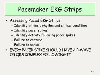 Pacemaker EKG Strips
• Assessing Paced EKG Strips
– Identify intrinsic rhythm and clinical condition
– Identify pacer spikes
– Identify activity following pacer spikes
– Failure to capture
– Failure to sense
• EVERY PACER SPIKE SHOULD HAVE A P-WAVE
OR QRS COMPLEX FOLLOWING IT.
35
 