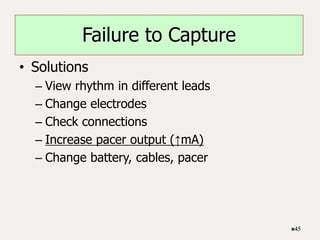• Solutions
– View rhythm in different leads
– Change electrodes
– Check connections
– Increase pacer output (↑mA)
– Change battery, cables, pacer
45
Failure to Capture
 