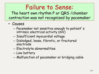 Failure to Sense:
The heart own rhythm P or QRS /chamber
contraction was not recognized by pacemaker
• Causes
– Pacemaker not sensitive enough to patient’s
intrinsic electrical activity (mV)
– Insufficient myocardial voltage
– Dislodged, loose, fibrotic, or fractured
electrode
– Electrolyte abnormalities
– Low battery
– Malfunction of pacemaker or bridging cable
56
 