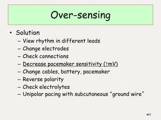 • Solution
– View rhythm in different leads
– Change electrodes
– Check connections
– Decrease pacemaker sensitivity (↑mV)
– Change cables, battery, pacemaker
– Reverse polarity
– Check electrolytes
– Unipolar pacing with subcutaneous “ground wire”
61
Over-sensing
 