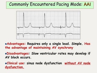 Advantages: Requires only a single lead. Simple. Has
the advantage of maintaining AV synchrony
Disadvantages: Slow ventricular rates may develop if
AV block occurs.
Clinical use: sinus node dysfunction without AV node
dysfunction.
Commonly Encountered Pacing Mode: AAI
 