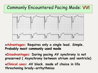 Advantages: Requires only a single lead. Simple.
Probably most commonly used mode
Disadvantages: During pacing AV synchrony is not
preserved ( Asynchrony between atrium and ventricle)
Clinical uses: AV block. mode of choice in life
threatening brady-arrhythmias
Commonly Encountered Pacing Mode: VVI
 