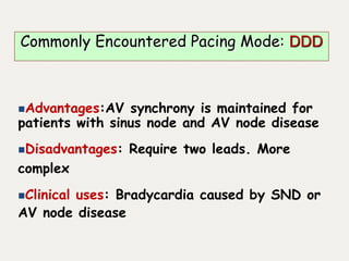 Advantages:AV synchrony is maintained for
patients with sinus node and AV node disease
Disadvantages: Require two leads. More
complex
Clinical uses: Bradycardia caused by SND or
AV node disease
Commonly Encountered Pacing Mode: DDD
 