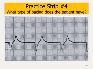 Practice Strip #4
What type of pacing does the patient have?
69
 