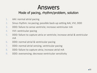 Answers
Mode of pacing, rhythm/problem, solution
1. AAI: normal atrial pacing
2. Sinus rhythm: no pacing; possible back-up setting AAI, VVI, DDD
3. DDD: failure to sense ventricle; increase ventricular mA
4. VVI: ventricular pacing
5. DDD: failure to capture atria or ventricle; increase atrial & ventricular
mA
6. DDD: normal atrial & ventricular pacing
7. DDD: normal atrial sensing, ventricular pacing
8. DDD: failure to capture atria; increase atrial mA
9. DDD: oversensing; decrease ventricular sensitivity
75
 