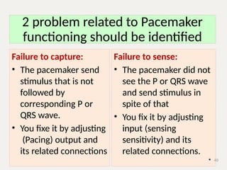 temporary pacemaker 2.pptx.............. | PPTX