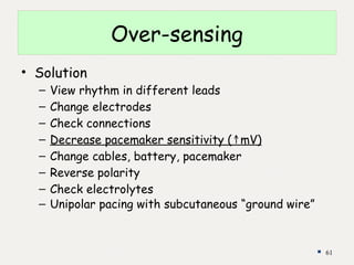 Ground Wire Pacemaker temporary pacemaker 2.pptx.............. | PPTX