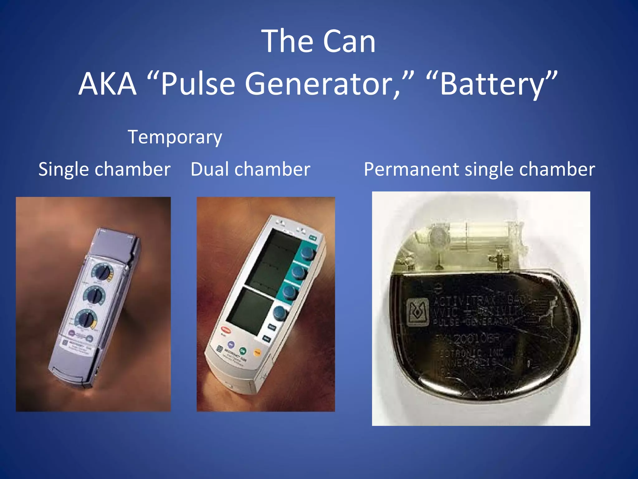 The Can
AKA “Pulse Generator,” “Battery”
Temporary
Single chamber Dual chamber Permanent single chamber
 