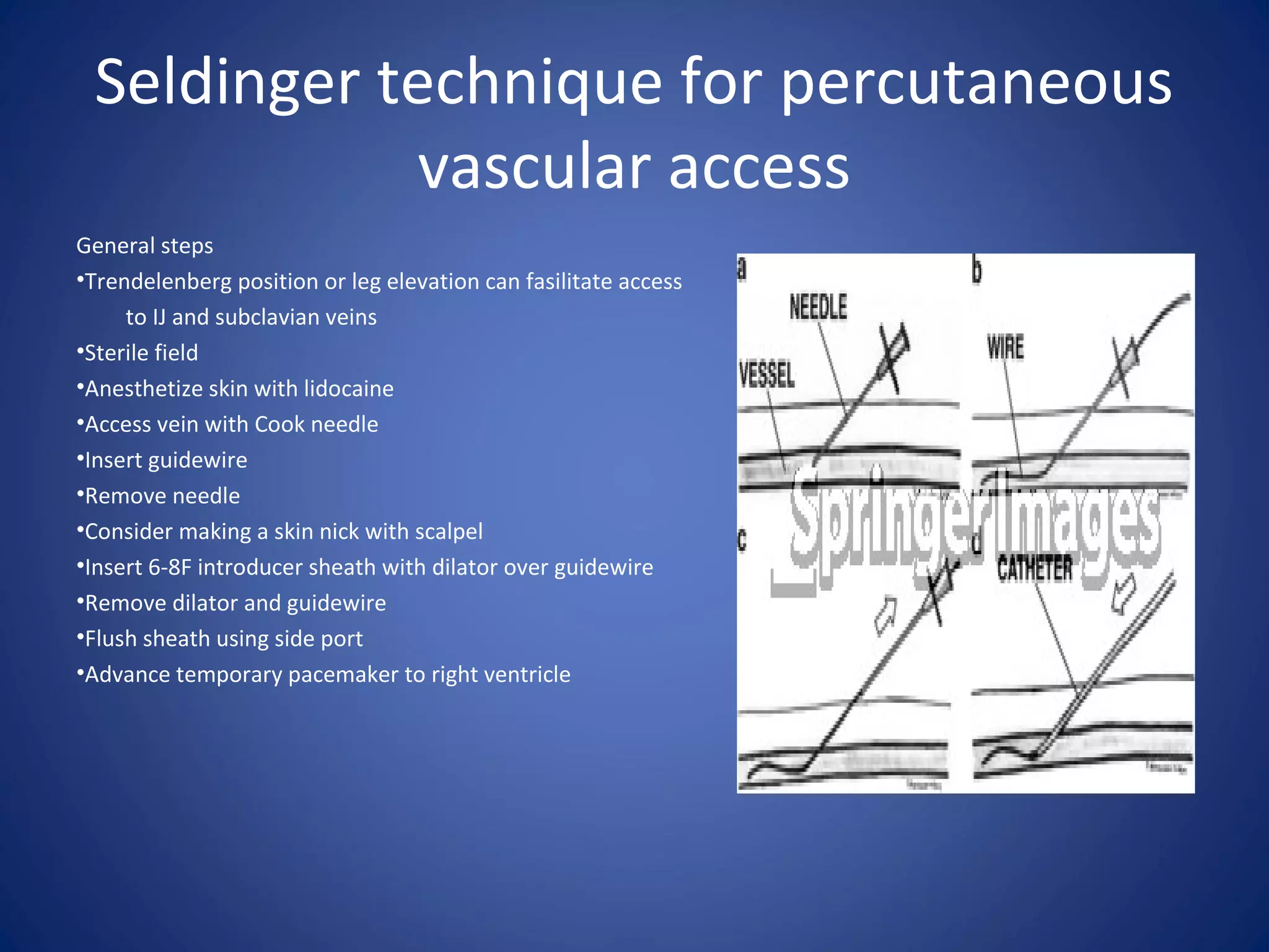 Seldinger technique for percutaneous
vascular access
General steps
•Trendelenberg position or leg elevation can fasilitate access
to IJ and subclavian veins
•Sterile field
•Anesthetize skin with lidocaine
•Access vein with Cook needle
•Insert guidewire
•Remove needle
•Consider making a skin nick with scalpel
•Insert 6-8F introducer sheath with dilator over guidewire
•Remove dilator and guidewire
•Flush sheath using side port
•Advance temporary pacemaker to right ventricle
 