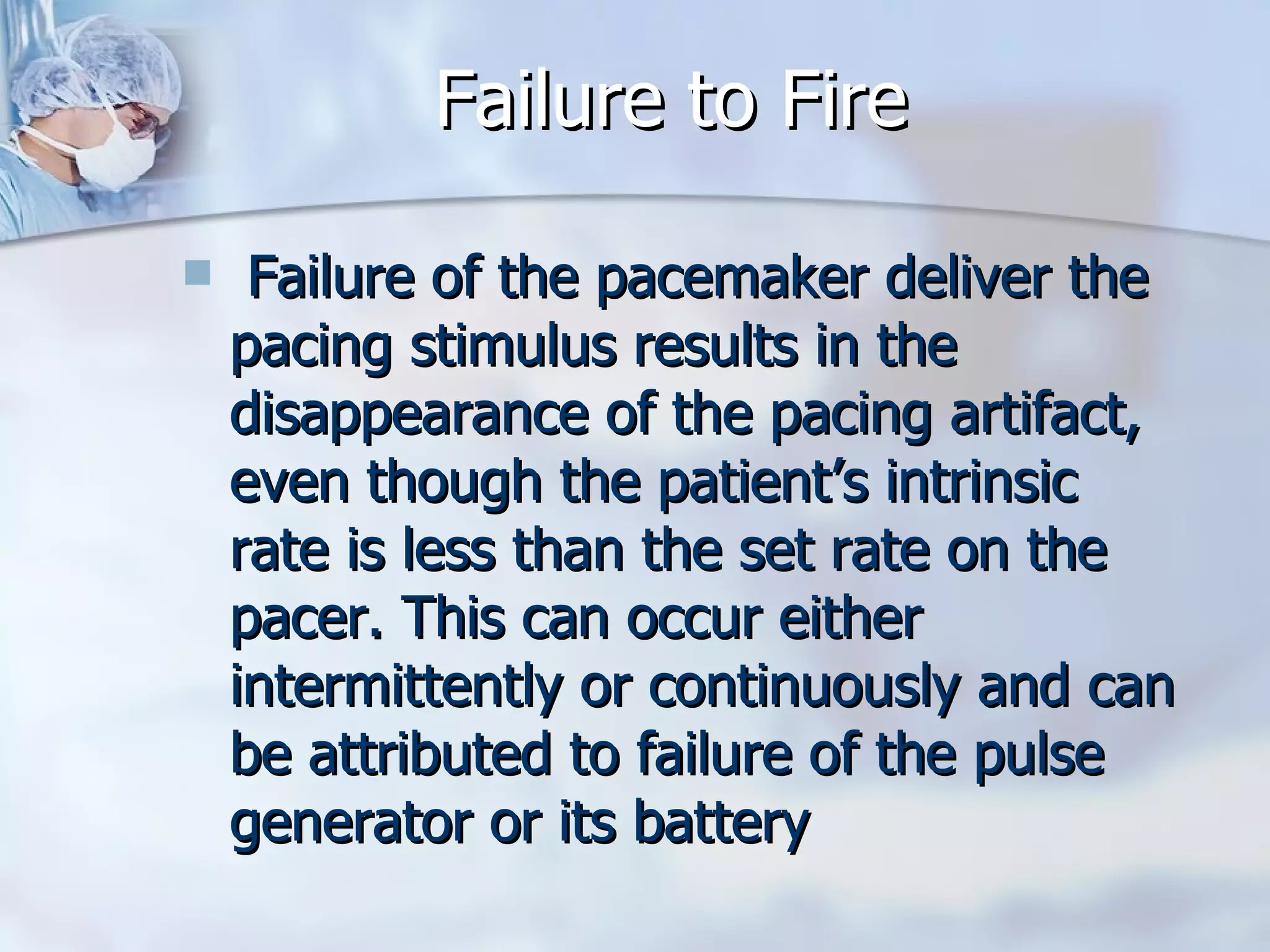Failure to Fire  Failure of the pacemaker deliver the pacing stimulus results in the disappearance of the pacing artifact, even though the patient’s intrinsic rate is less than the set rate on the pacer. This can occur either intermittently or continuously and can be attributed to failure of the pulse generator or its battery  