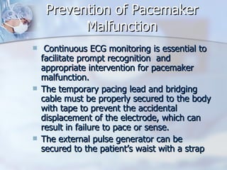 Temporary Pacemaker Slides | PPT