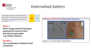Externalized battery
When ?
When longer period of pacing is
expected and cannot insert
permanent pacemaker:
e.g. Pocket infection
Benefits?
Less complication related to lead
movement
 
