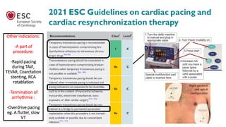Other indications:
-A part of
procedure:
-Rapid pacing
during TAVI,
TEVAR, Coarctation
stenting, RCA
rotablation
-Termination of
arrhythmia :
-Overdrive pacing
eg. A.flutter, slow
VT
 