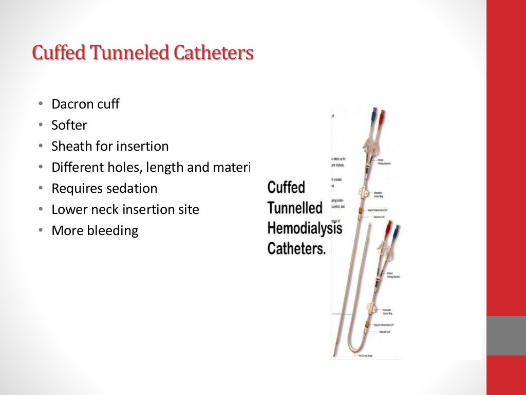 Temporary vascular access for hemodialysis