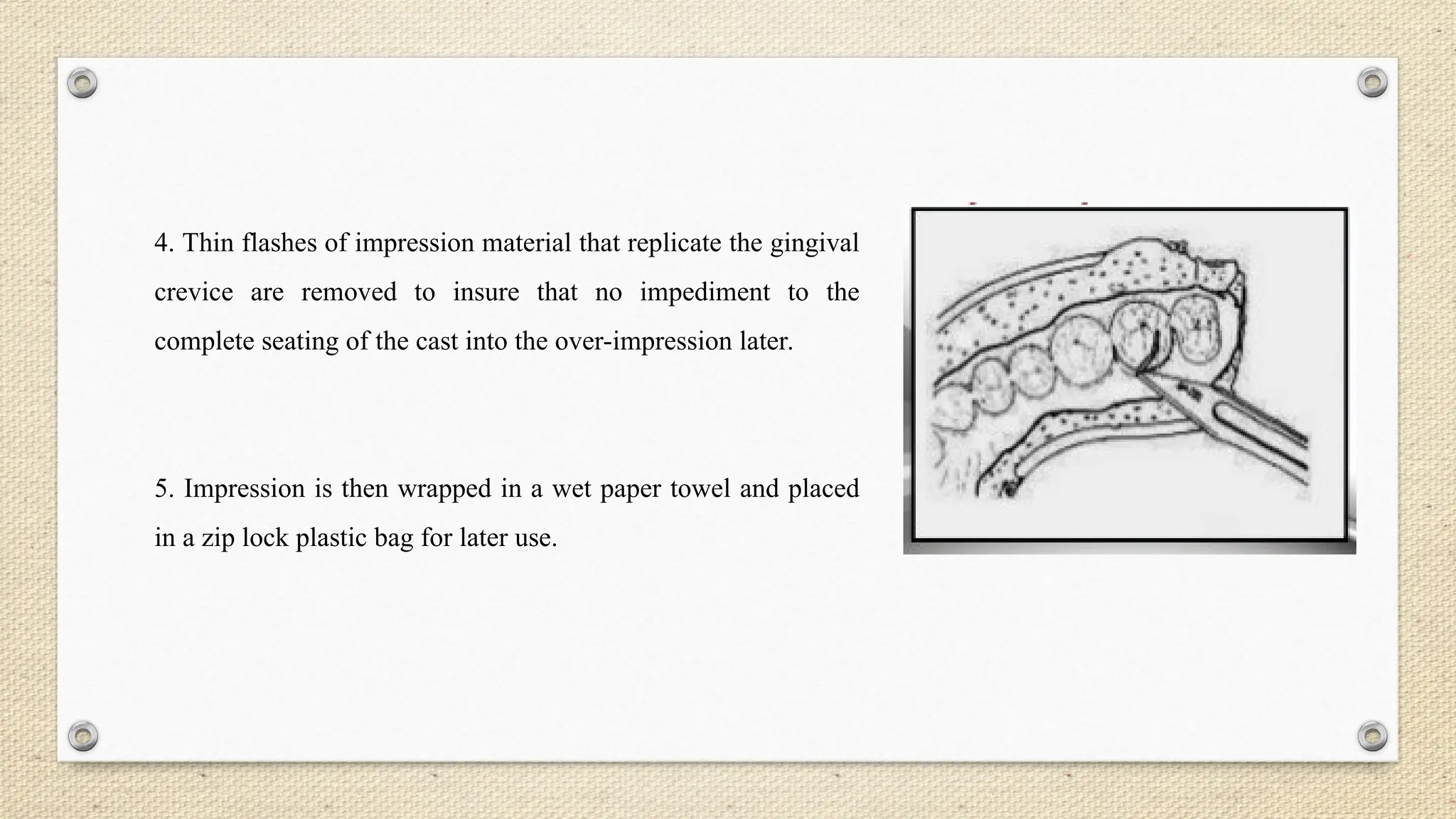 4. Thin flashes of impression material that replicate the gingival
crevice are removed to insure that no impediment to the
complete seating of the cast into the over-impression later.
5. Impression is then wrapped in a wet paper towel and placed
in a zip lock plastic bag for later use.
 