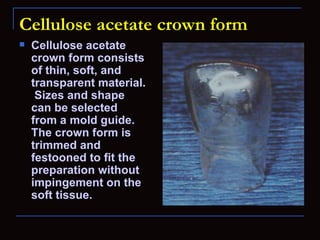 Cellulose acetate crown form
   Cellulose acetate
    crown form consists
    of thin, soft, and
    transparent material.
     Sizes and shape
    can be selected
    from a mold guide.
    The crown form is
    trimmed and
    festooned to fit the
    preparation without
    impingement on the
    soft tissue.
 