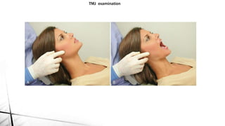Tempormandibular disorders & orthodontics | PPTX