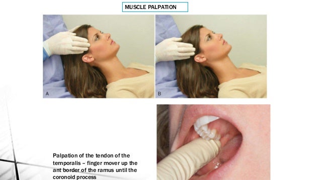 tmj orthodontics