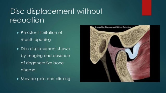 Temporomandibular disorders