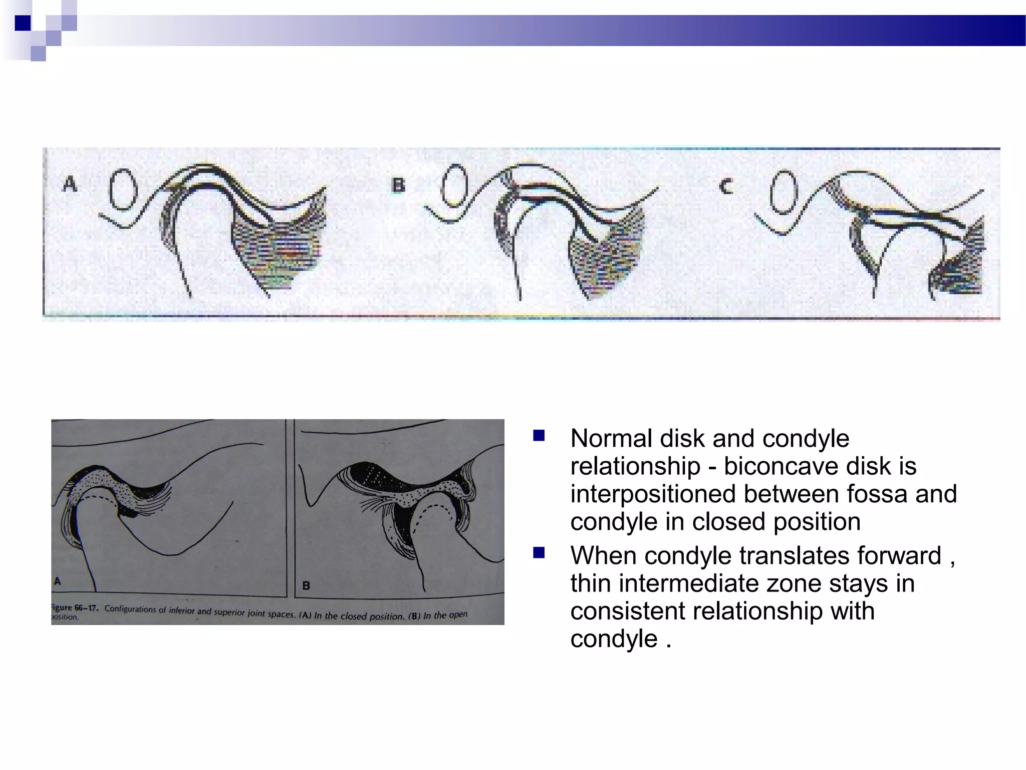 Temporomandibular joint | PPT