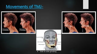 Tmj Over Rotation temporomandibular joint.pptx