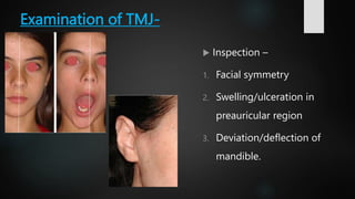 Tmj Deviation Deflection temporomandibular joint.pptx