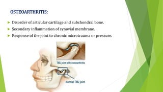 OSTEOARTHRITIS:
 Disorder of articular cartilage and subchondral bone.
 Secondary inflammation of synovial membrane.
 Response of the joint to chronic microtrauma or pressure.
 