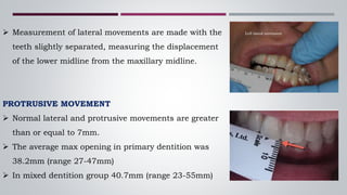 Temporomandibular joint 1 | PPTX