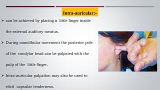  can be achieved by placing a little finger inside
the external auditory meatus.
 During mandibular movement the posterior pole
of the condylar head can be palpated with the
pulp of the little finger.
 Intra-auricular palpation may also be used to
elicit capsular tenderness.
Intra-auricular:-
 