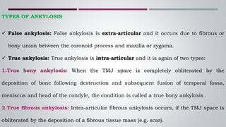 TYPES OF ANKYLOSIS
 False ankylosis: False ankylosis is extra-articular and it occurs due to fibrous or
bony union between the coronoid process and maxilla or zygoma.
 True ankylosis: True ankylosis is intra-articular and it is again of two types:
1.True bony ankylosis: When the TMJ space is completely obliterated by the
deposition of bone following destruction and subsequent fusion of temporal fossa,
meniscus and head of the condyle, the condition is called a true bony ankylosis .
2.True fibrous ankylosis: Intra-articular fibrous ankylosis occurs, if the TMJ space is
obliterated by the deposition of a fibrous tissue mass (e.g. scar).
 