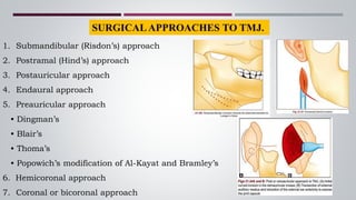 1. Submandibular (Risdon’s) approach
2. Postramal (Hind’s) approach
3. Postauricular approach
4. Endaural approach
5. Preauricular approach
• Dingman’s
• Blair’s
• Thoma’s
• Popowich’s modification of Al-Kayat and Bramley’s
6. Hemicoronal approach
7. Coronal or bicoronal approach
 