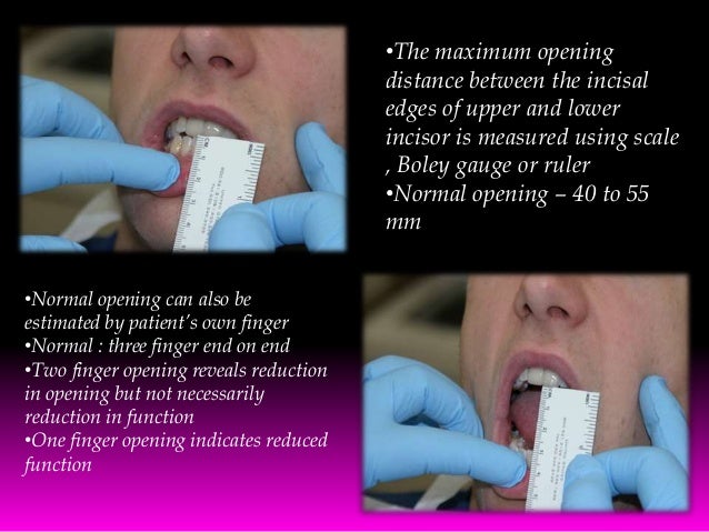 the study of temporomandibular joint and its function In non-patient population studies, three out of four have at least one joint this is possibly due to the nature of the lining of the tmj with its ability to the goals of treatment for tmd are to decrease pain, and to restore normal function. the study of temporomandibular joint and its function In non-patient population studies, three out of four have at least one joint this is possibly due to the nature of the lining of the tmj with its ability to the goals of treatment for tmd are to decrease pain, and to restore normal function.