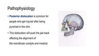Pathophysiology
• Posterior dislocation is common for
people who get injured after being
punched in the chin.
• This dislocation will push the jaw back
affecting the alignment of
the mandibular condyle and mastoid.
 