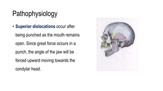 Pathophysiology
• Superior dislocations occur after
being punched as the mouth remains
open. Since great force occurs in a
punch, the angle of the jaw will be
forced upward moving towards the
condylar head.
 