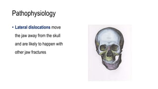 Pathophysiology
• Lateral dislocations move
the jaw away from the skull
and are likely to happen with
other jaw fractures
 