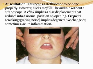 Temporomandibular Joint Disorders in Children.pdf