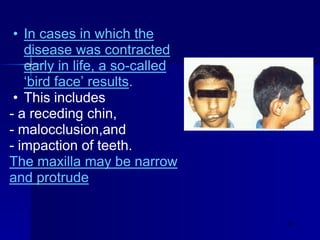 Temporomandibular joint disorders IV | PDF