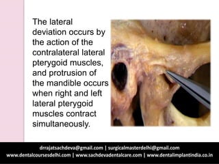 The lateral
deviation occurs by
the action of the
contralateral lateral
pterygoid muscles,
and protrusion of
the mandible occurs
when right and left
lateral pterygoid
muscles contract
simultaneously.
 