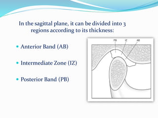 In the sagittal plane, it can be divided into 3
regions according to its thickness:
 Anterior Band (AB)
 Intermediate Zone (IZ)
 Posterior Band (PB)
 