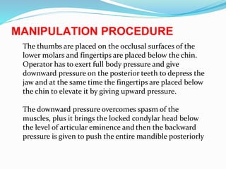 MANIPULATION PROCEDURE
The thumbs are placed on the occlusal surfaces of the
lower molars and fingertips are placed below the chin.
Operator has to exert full body pressure and give
downward pressure on the posterior teeth to depress the
jaw and at the same time the fingertips are placed below
the chin to elevate it by giving upward pressure.
The downward pressure overcomes spasm of the
muscles, plus it brings the locked condylar head below
the level of articular eminence and then the backward
pressure is given to push the entire mandible posteriorly
 