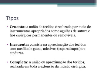 Tipos
• Cruenta: a união de tecidos é realizada por meio de
instrumentos apropriados como agulhas de sutura e
fios cirúrgicos permanentes ou removíveis.
• Incruenta: consiste na aproximação dos tecidos
com auxílio de gesso, adesivos (esparadrapos) ou
ataduras.
• Completa: a união ou aproximação dos tecidos,
realizada em toda a extensão da incisão cirúrgica.
 