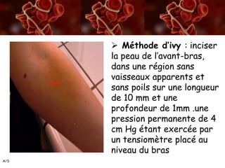 A/S
 Méthode d’ivy : inciser
la peau de l’avant-bras,
dans une région sans
vaisseaux apparents et
sans poils sur une longueur
de 10 mm et une
profondeur de 1mm .une
pression permanente de 4
cm Hg étant exercée par
un tensiomètre placé au
niveau du bras
 