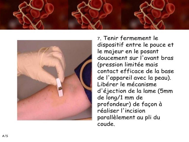 Temps de saignement