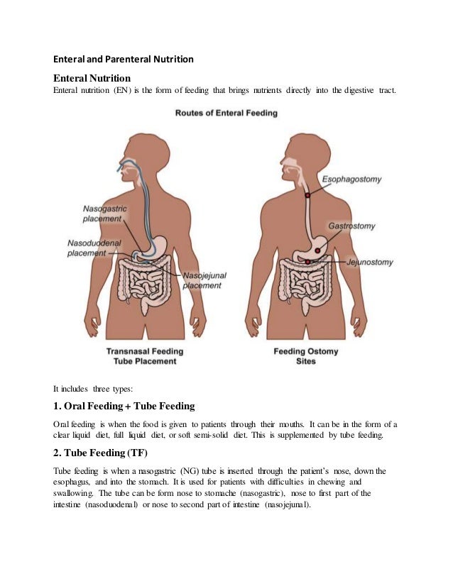 Enteral Feeding Vs Total Parenteral Nutrition Nutrition Pics