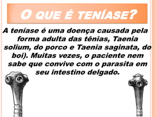 O QUE É TENÍASE?
A teníase é uma doença causada pela
forma adulta das tênias, Taenia
solium, do porco e Taenia saginata, do
boi). Muitas vezes, o paciente nem
sabe que convive com o parasita em
seu intestino delgado.

 