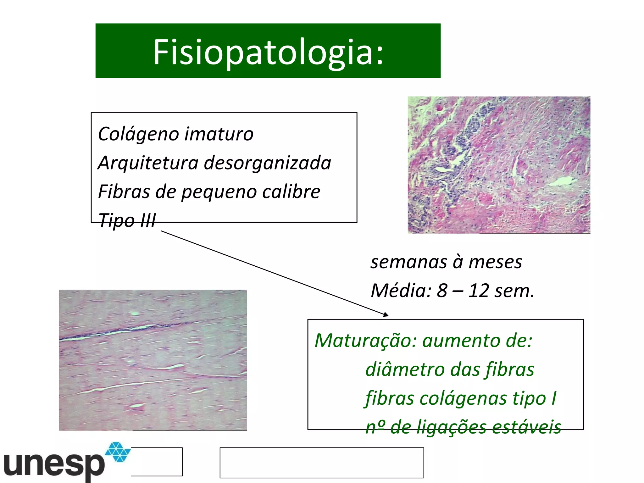 Fisiopatologia: Colágeno imaturo Arquitetura desorganizada Fibras de pequeno calibre Tipo III Maturação: aumento de:  diâmetro das fibras fibras colágenas tipo I nº de ligações estáveis semanas à meses Média: 8 – 12 sem. 