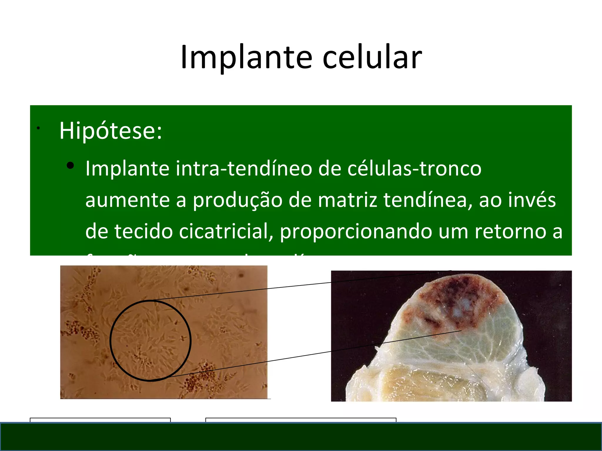 Implante celular Hipótese:  Implante intra-tendíneo de células-tronco aumente a produção de matriz tendínea, ao invés de tecido cicatricial, proporcionando um retorno a função estrutural tendínea. 