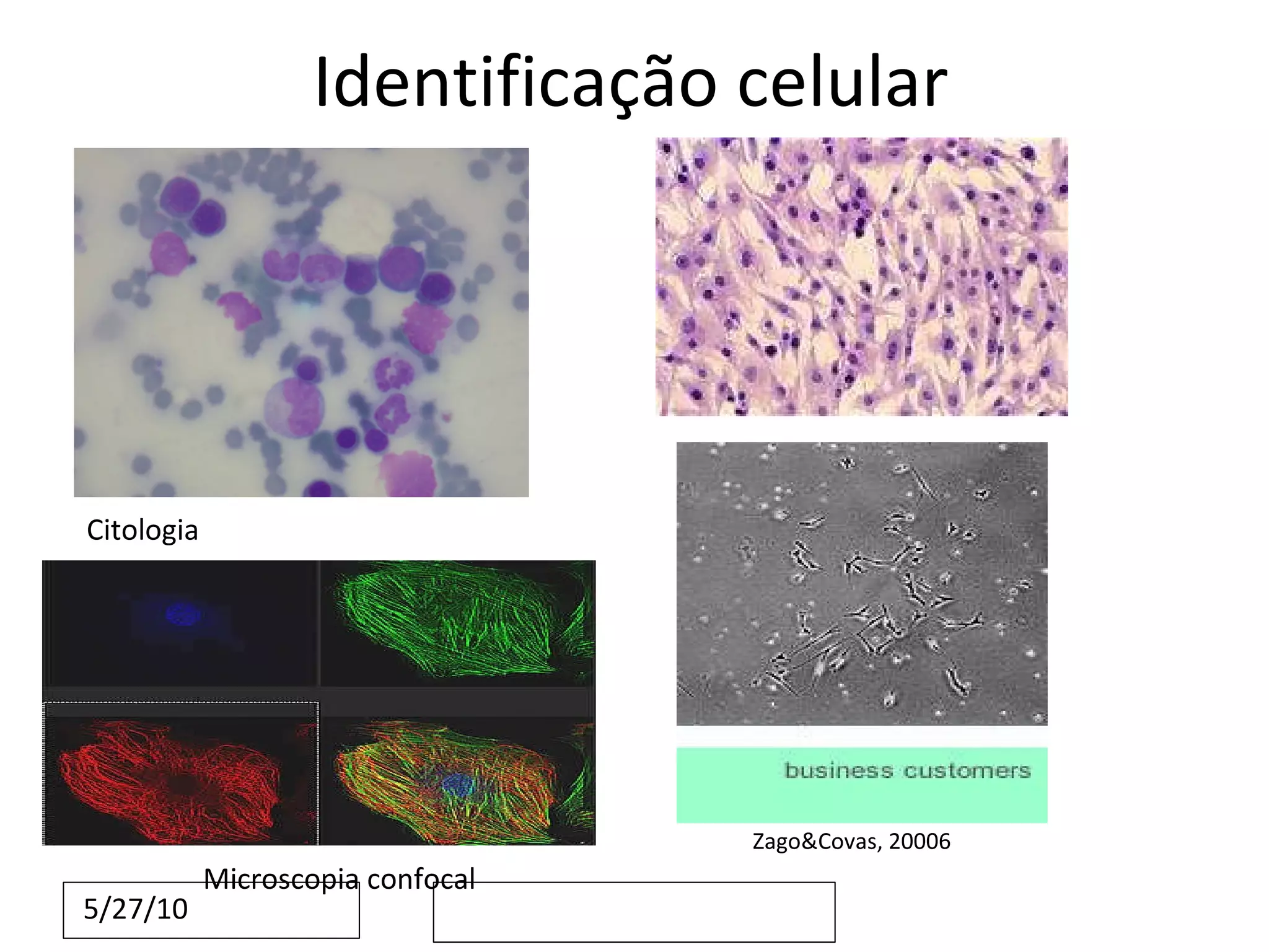 Identificação celular Citologia Zago&Covas, 20006 Microscopia confocal 
