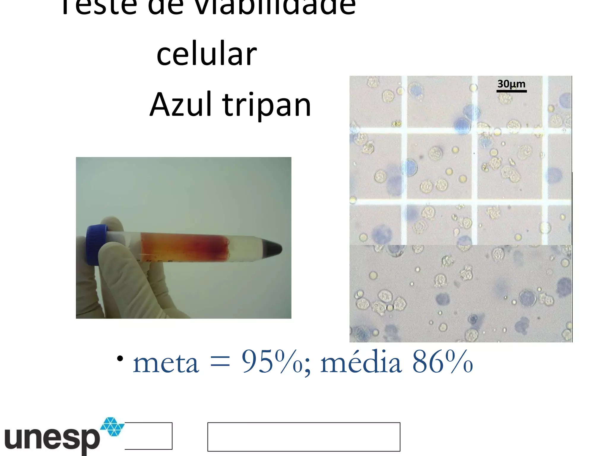 Teste de viabilidade celular Azul tripan meta = 95%; média 86% 30µm 